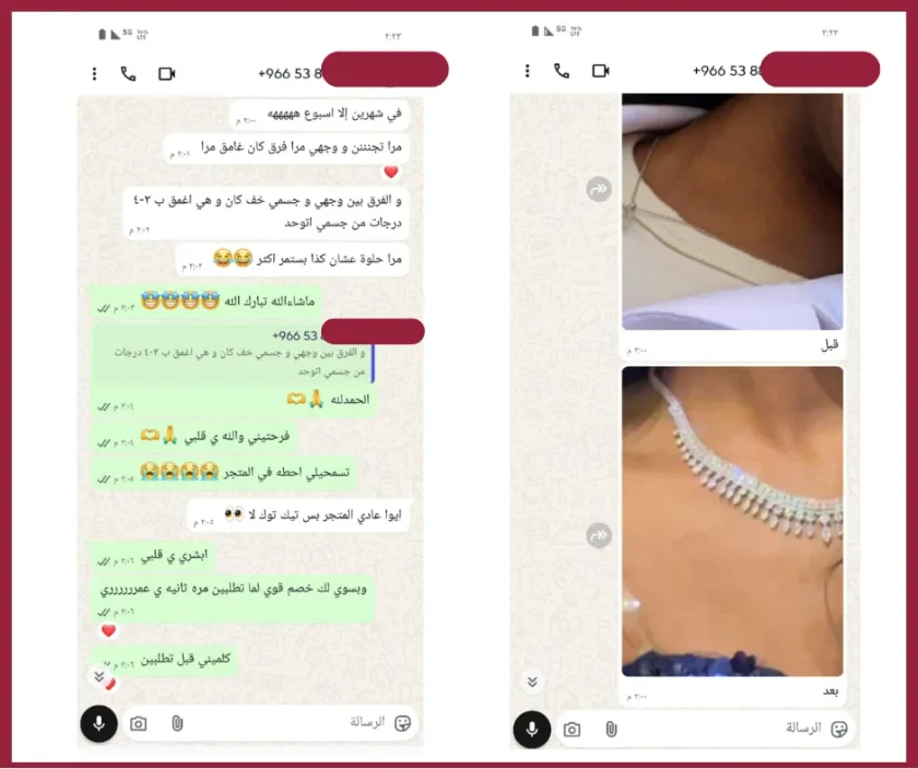 محادثة واتساب حقيقية — عميلة تشارك فرق بشرتها بعد الاستخدام