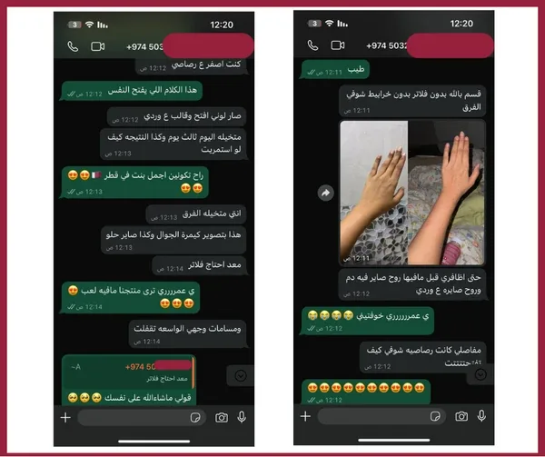 محادثة واتساب حقيقية — عميلة تشارك صور قبل وبعد لبشرتها